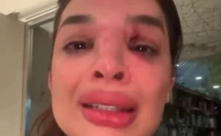 Suposta violência patrimonial contra dentista agredida por empresário é investigada