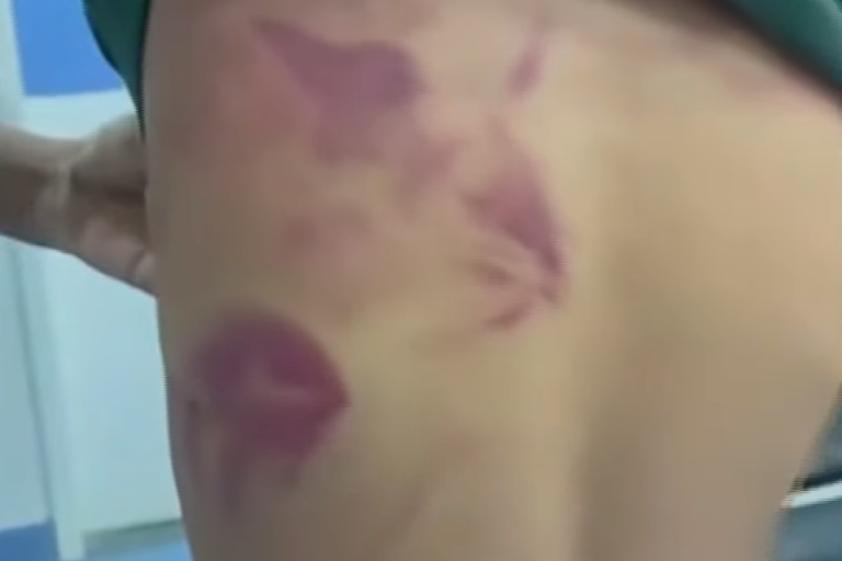 Pai é preso após agredir filho de 13 anos por usar brinco