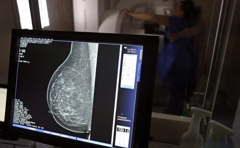 Plano de saúde terá que cobrir mamografia digital para todas as idades