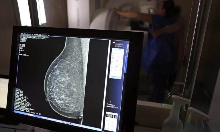 Planos de saúde terão que cobrir mamografia digital para todas as idades