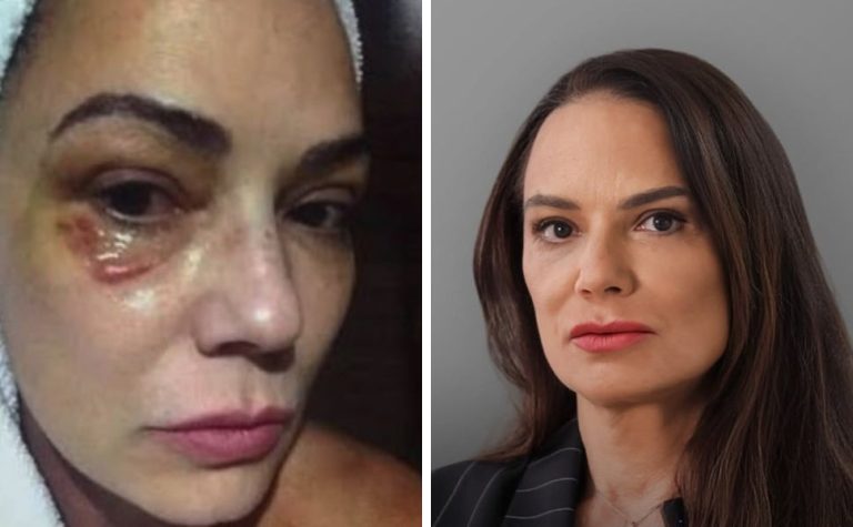 Luiza Brunet comenta indenização de R$ 150 mil por agressão de ex